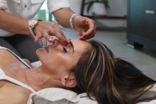 Acupunctura - avantaje si beneficii