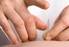Cabinet Acupunctura Targoviste