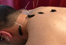 Medic Acupunctura Brasov Cabinet de acupunctura Brasov - HRIADA THERAPY - Dr. Hrihor Adrian