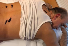 Medic Acupunctura Brasov Cabinet de acupunctura Brasov - HRIADA THERAPY - Dr. Hrihor Adrian